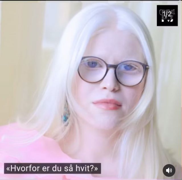 I dag skriver Sentralstyremedlem, Nora Sulejmani et personlig innlegg i NRK P3 om hvordan hun opplever å bli snikfotografert på gata, få upassende spørsmål til enhver tid og bli "klovnen på festen" fordi hun har et annerledes utseende det mange beregner som "normalt". 

Nora har albinisme og har derfor ingen pigmenter i hår, hud og øyne. Dette er ikke rart, det er unikt! 

Stå på, Nora og takk for at du deler disse tankene med oss 🌸🧚🏻‍♂️

Video og bilder fra NRK / @maudlervik / @nrkp3